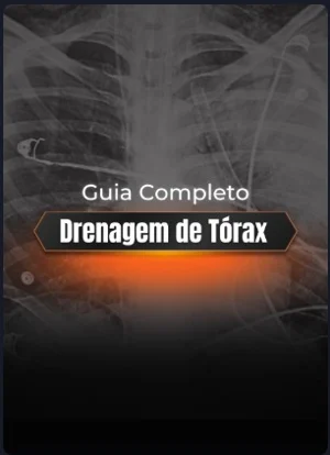 Guia Completo de Drenagem de Tórax